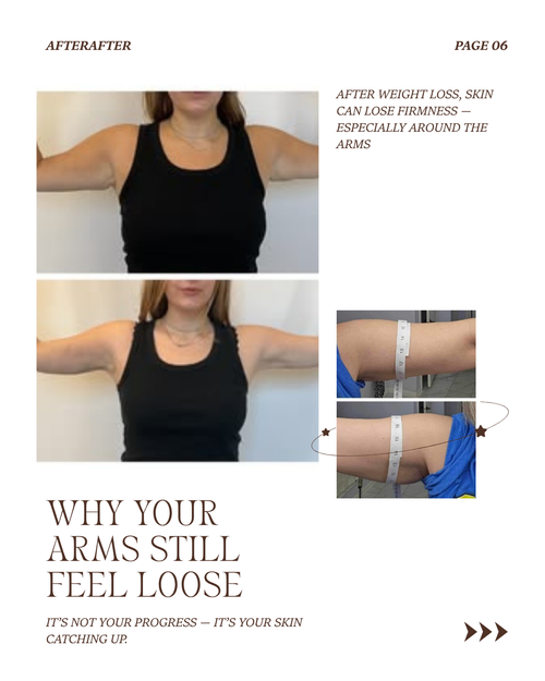 Arm Tone Cream